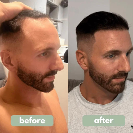 Bodywise hair growth serum