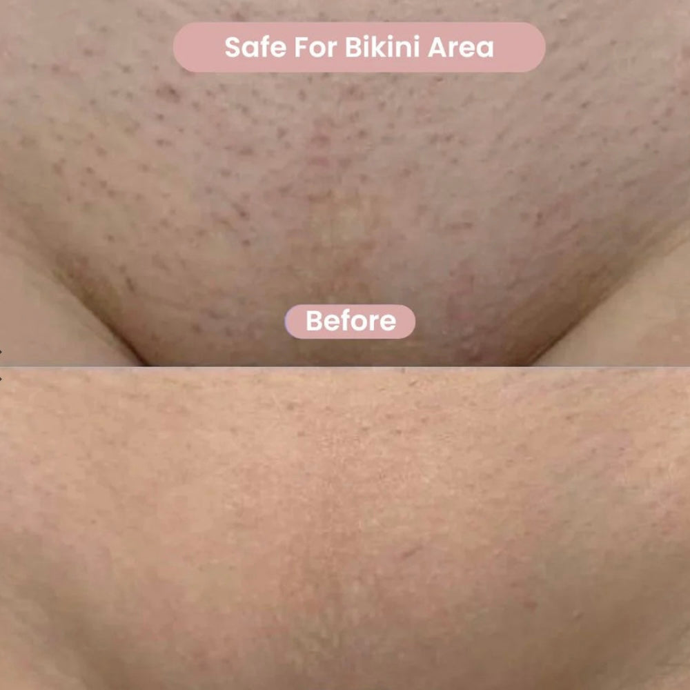 BikiDuo™ 2-in-1 Bikini and body trimmer