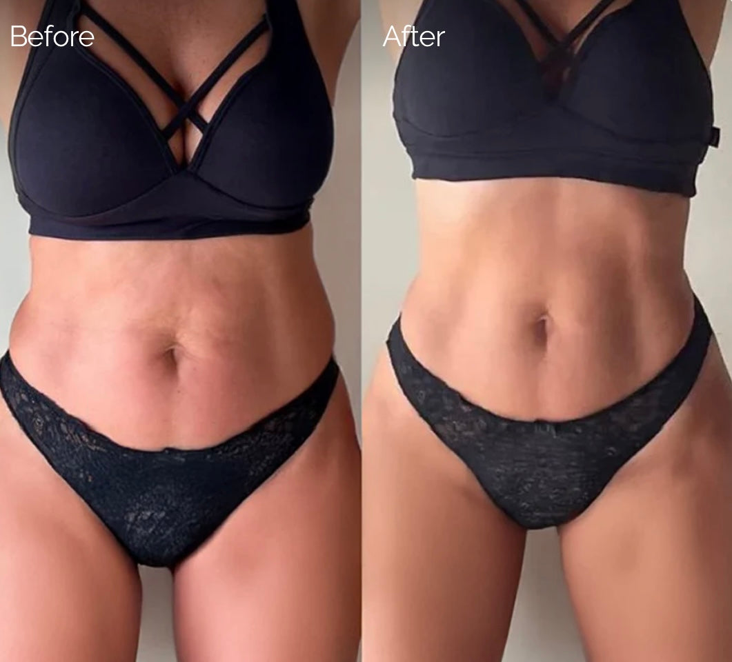 CelluLift™