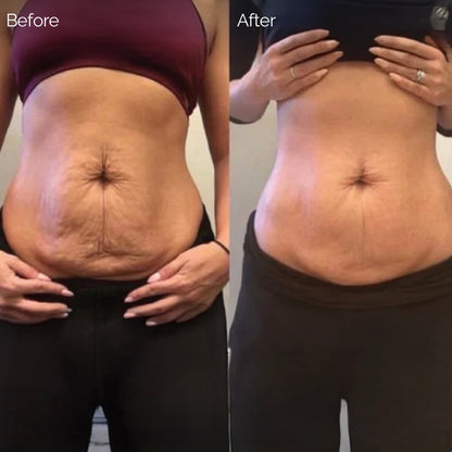 CelluLift™