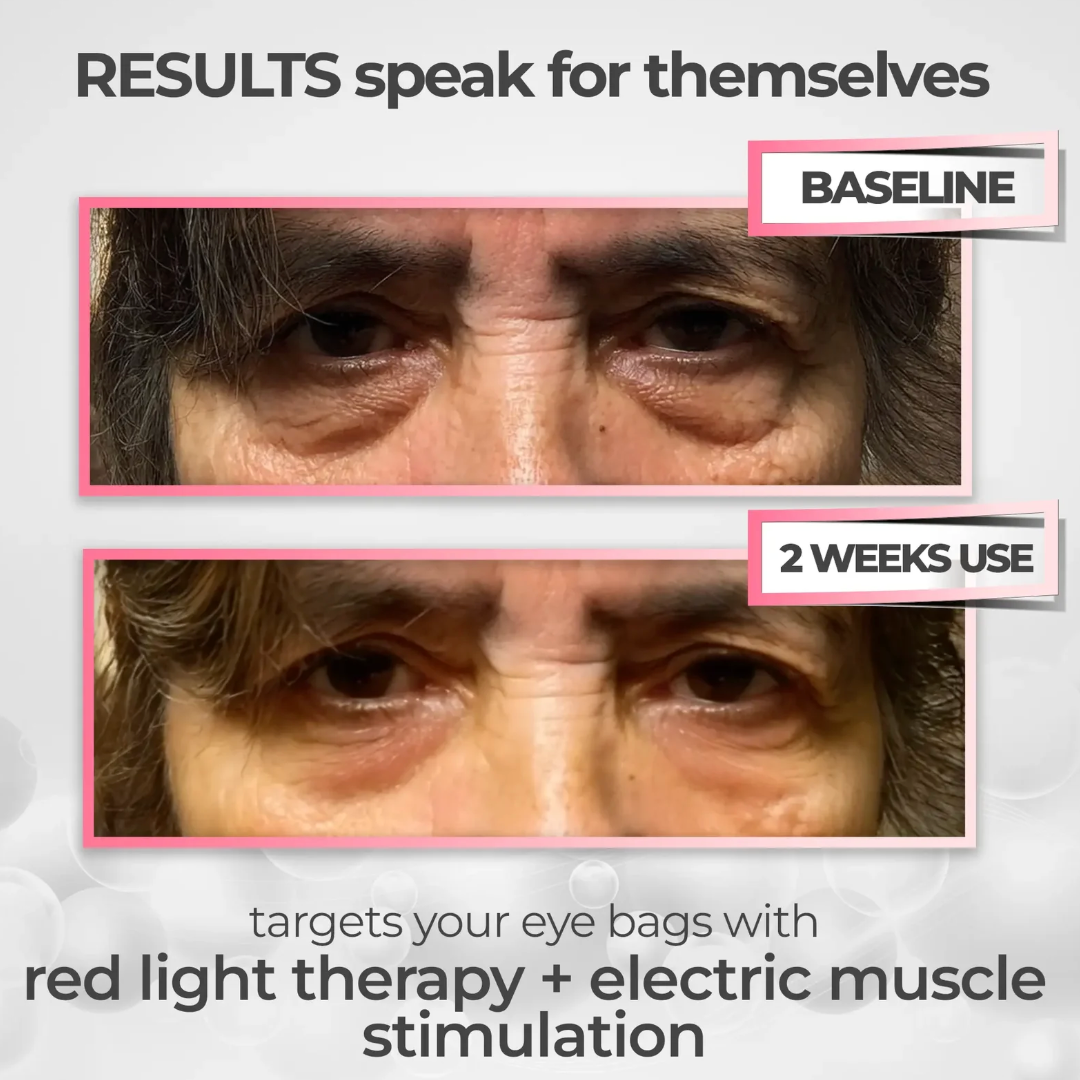 LumiEyes Pro