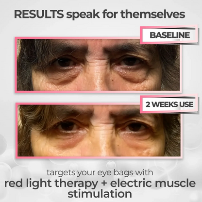 LumiEyes Pro